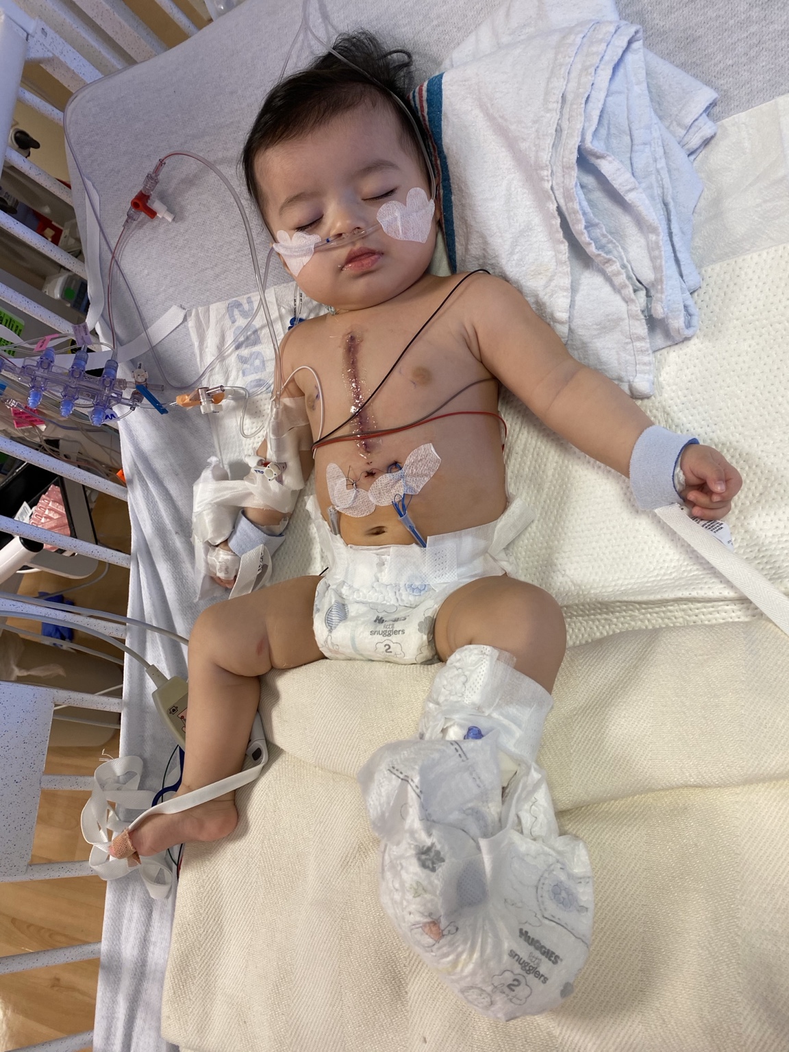 Nancy’s daughter resting after surgery, wrapped in blankets and holding a stuffed rabbit
